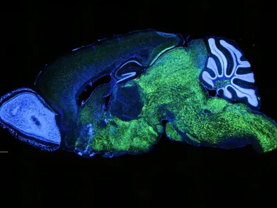 Cells producing the NOVA1 protein are shown in green in the brain of a mouse. A specific variant of this protein is unique to humans, and researchers suggest it is linked to spoken language development.