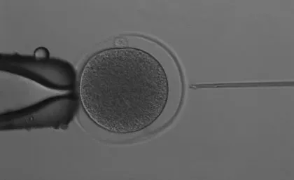 An image showing the fertilization process
