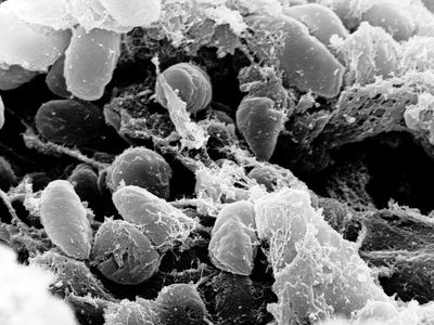 Bubonic plague is one of three types of plague infections, all stemming from the Yersinia pestis bacterium.